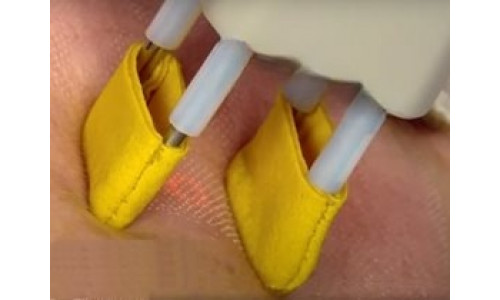 Запчасти разные Чехол лазера deka smartxide dot